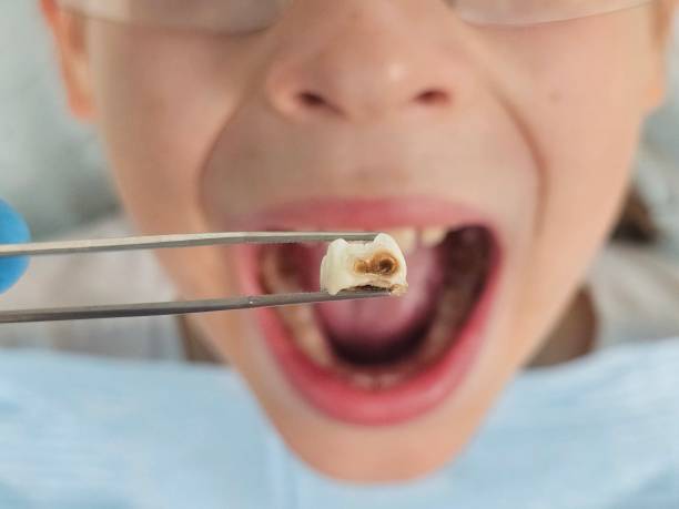 Best Orthodontic Emergency Dentist in Cottonwood, CA